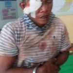 Sempat Di Hakimi Warga, Pelaku Penggelapan Sepeda Motor Di Bekuk Polisi