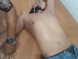 Perbaiki Tiang Kabel, 3 Pekerja Telkom Tersengat Listrik, Nyaris Gosong