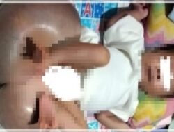 Bayi Iparbondar Pengidap Penyakit Bawaan Dari Lahir Butuh Perhatian Dermawan